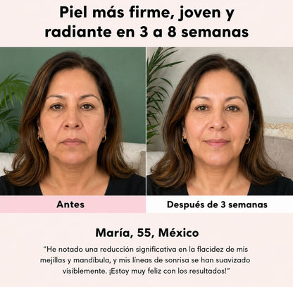 LumiGlow Pro™ - Mascarilla LED para Levantar Óvalo, Mejillas y Papada